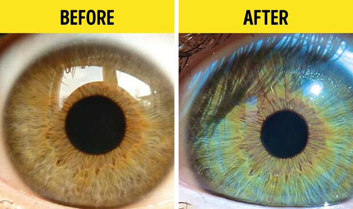 7 Vecí, ktoré môžu zmeniť farbu vášho oka