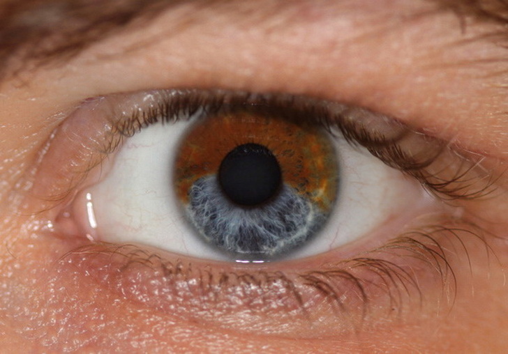 7 Vecí, ktoré môžu zmeniť farbu vášho oka