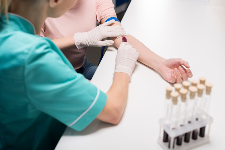 9 Vecí, ktoré by mal vedieť každý dospelý človek o krvných testoch